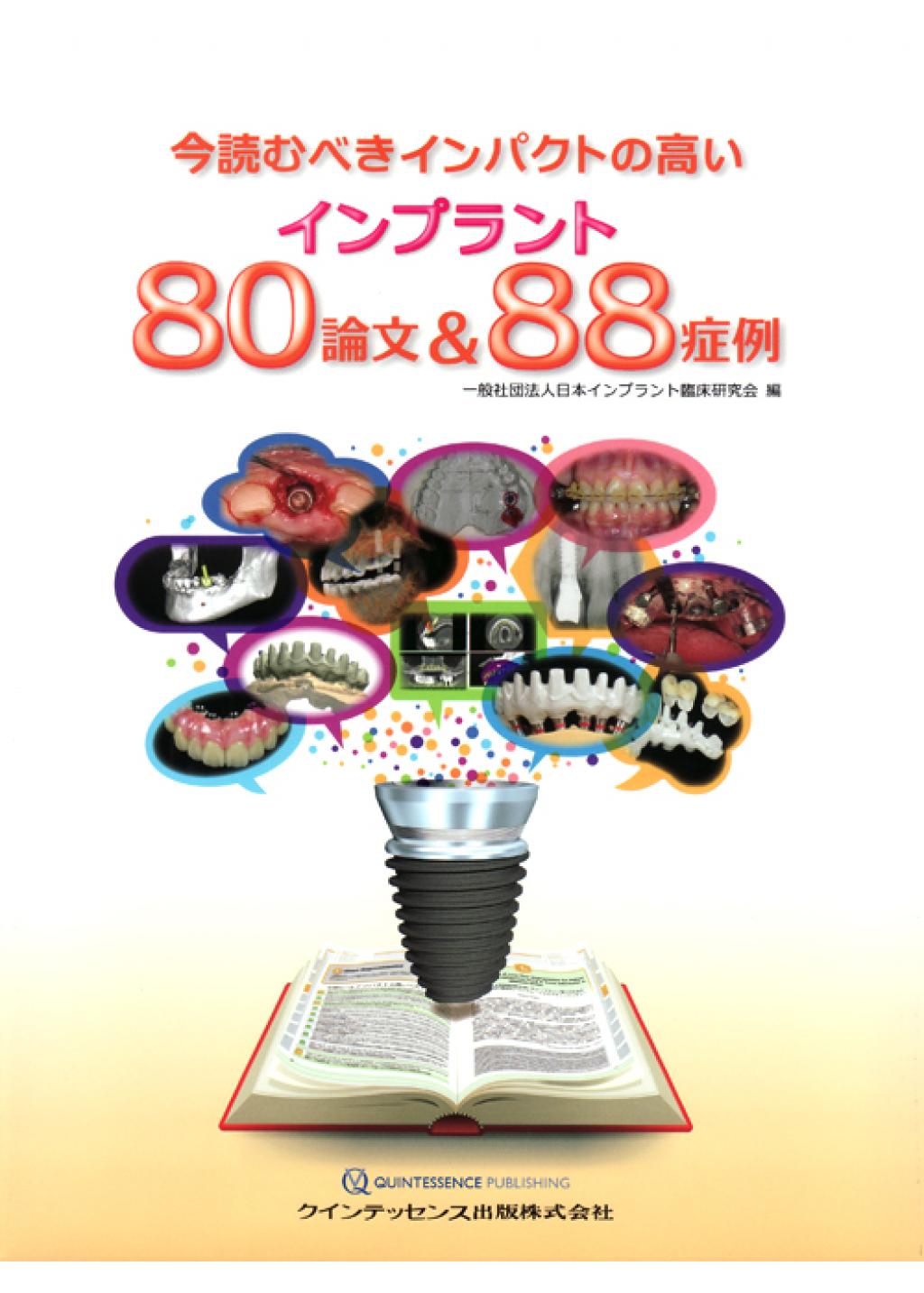 今読むべきインパクトの高いインプラント80論文＆88症例の購入なら