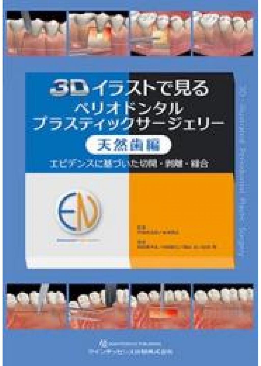CROSS　3Dイラストで見るペリオドンタルプラスティックサージェリー　天然歯編の購入ならWHITE