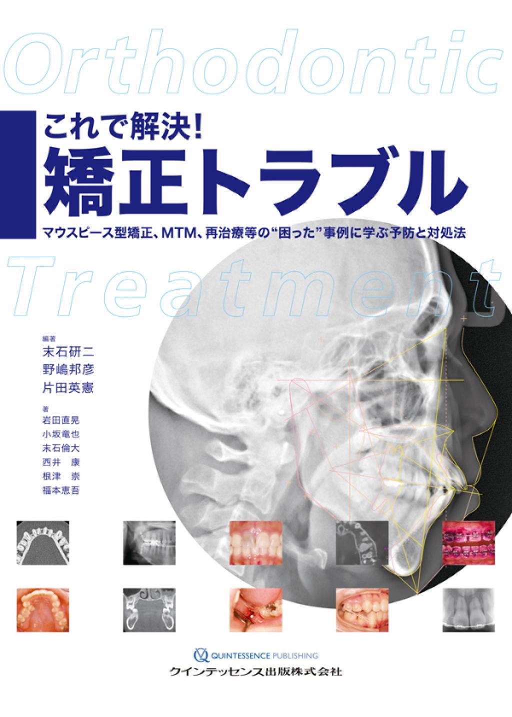 裁断済み】132 「無理しない」「無駄にしない」矯正歯科治療13の視点と 