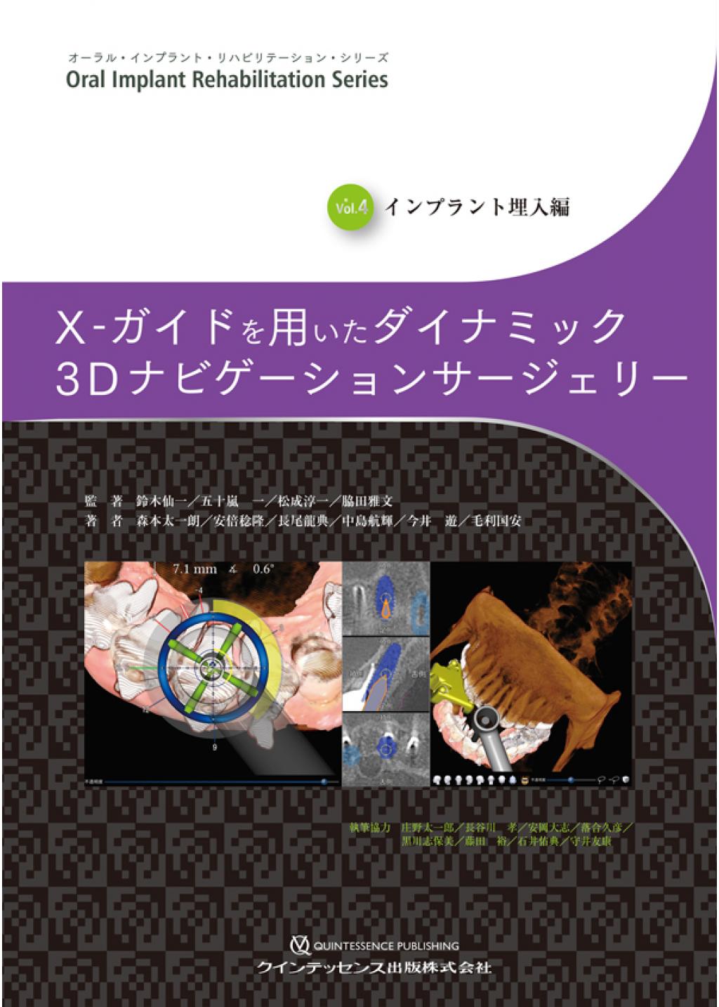 4-Dコンセプトインプラントセラピー 歯科 審美 - 健康/医学