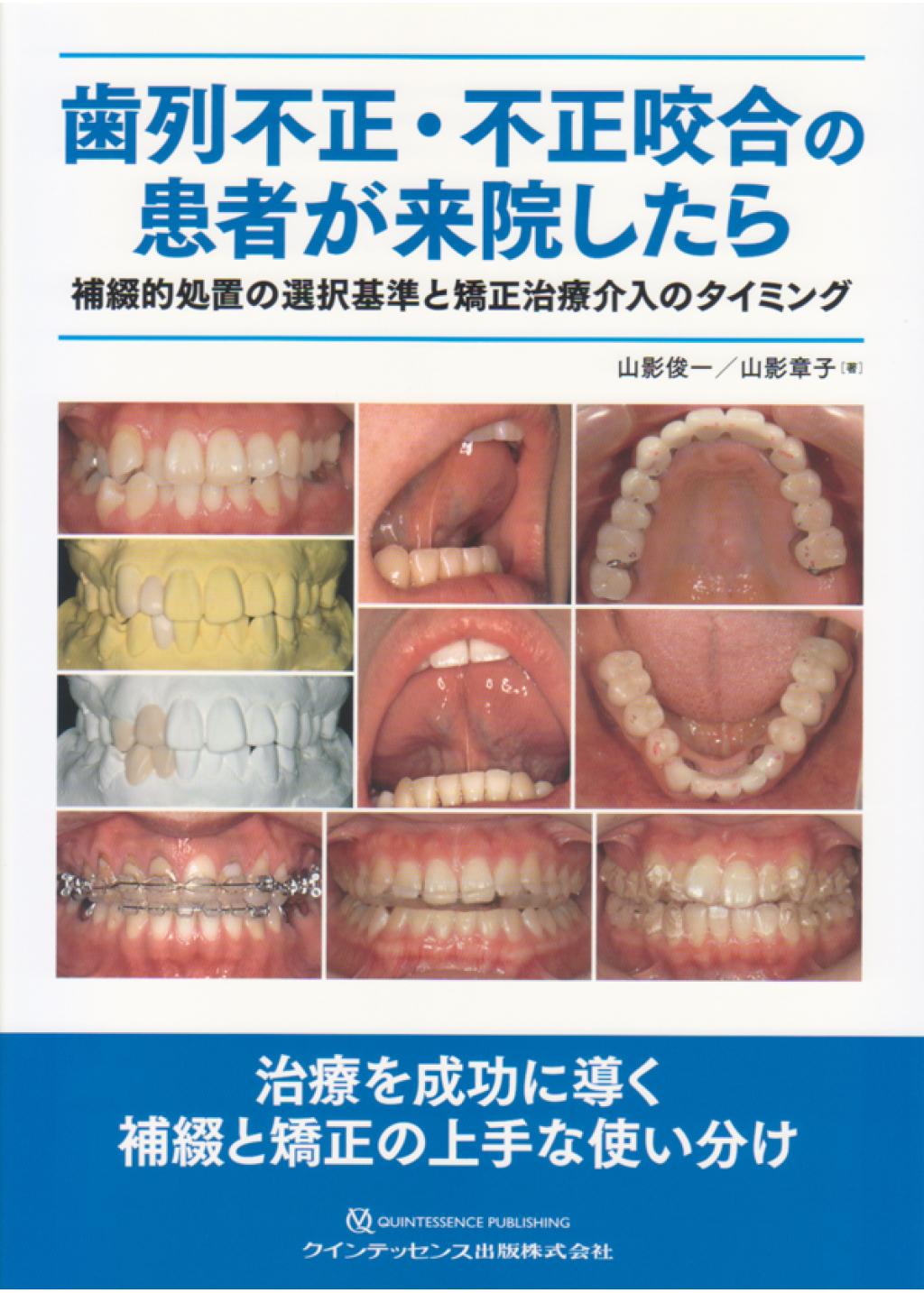 実践 咬合再構成を極める 歯列不正、歯周疾患、多数歯欠損を読み解く-
