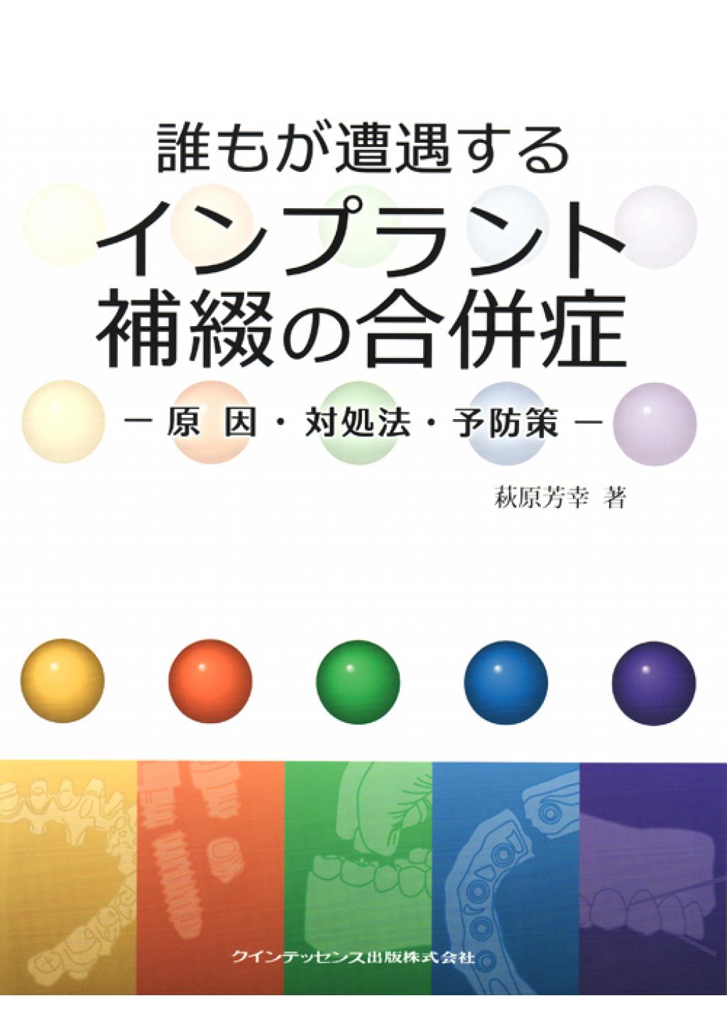 併発症インプラント併発症―予防と治療のポイント