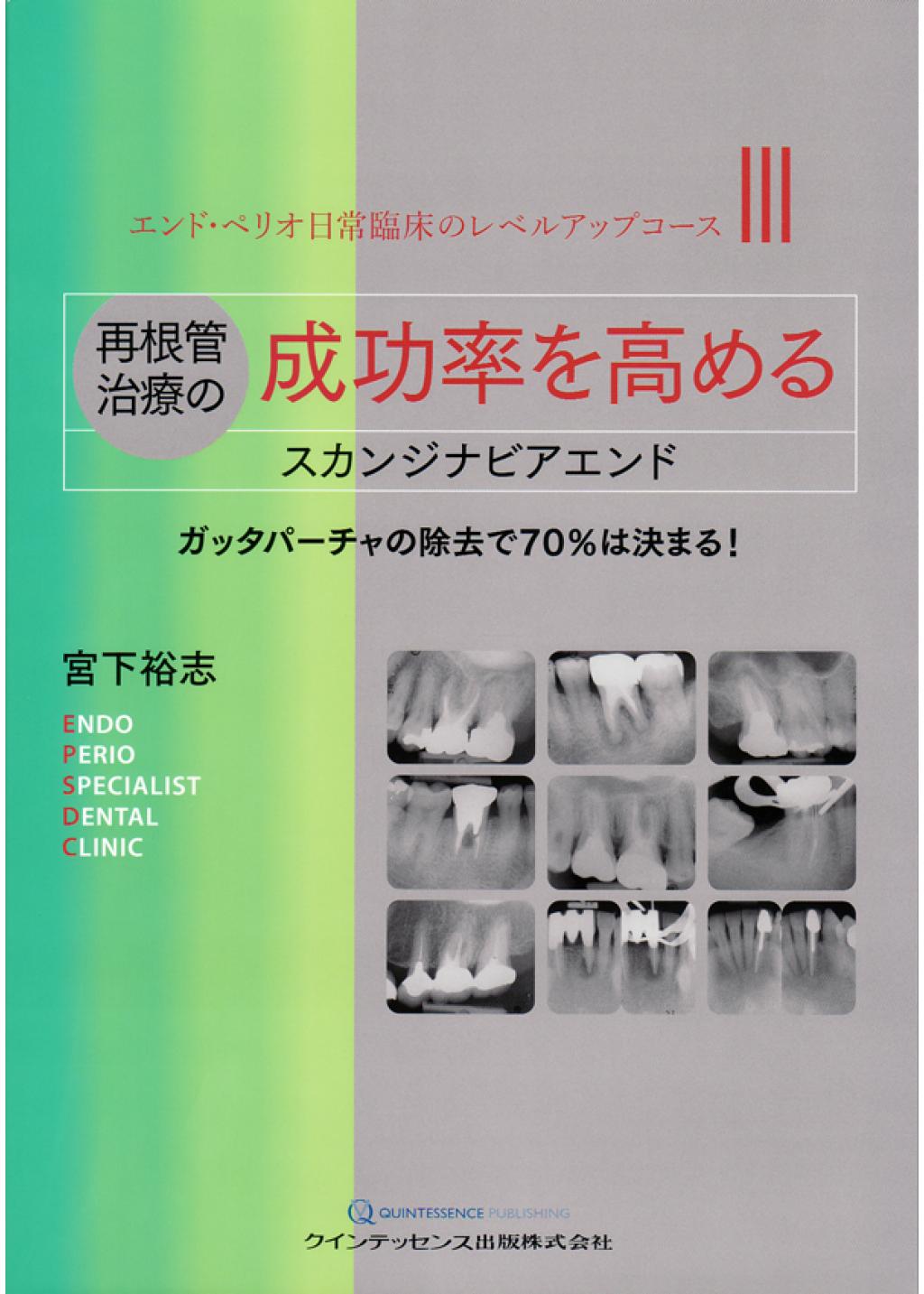 再根管治療の成功率を高めるスカンジナビアエンドの購入なら