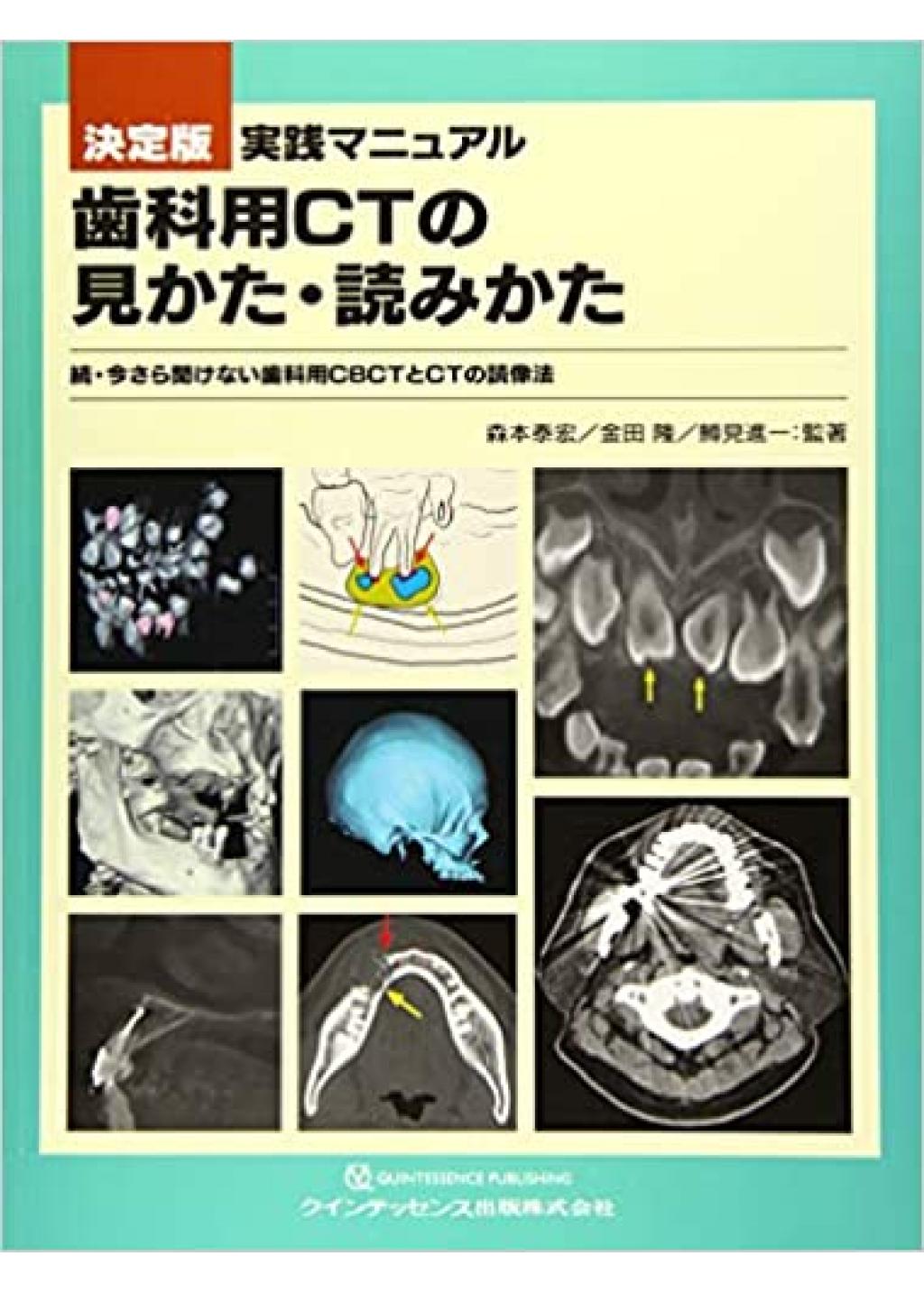 Case Based Learning 画像診断に学ぶ 難易度別口腔インプラント治療