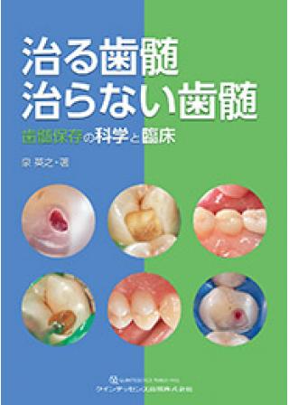 治癒の歯内療法 第3版の購入ならWHITE CROSS