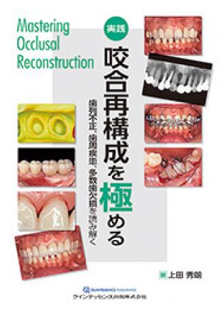 歯周再生療法とその応用
