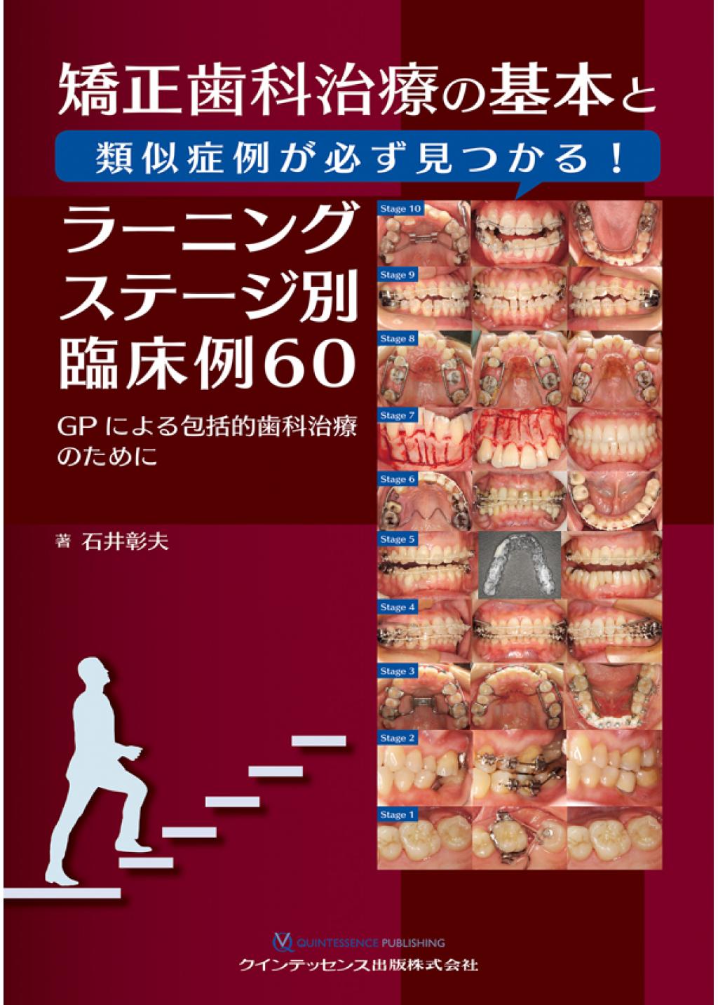 矯正歯科治療の基本と類似症例が必ず見つかる！ラーニングステージ別