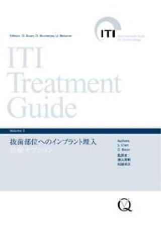 ITI Treatment Guide Volume 3 抜歯部位へのインプラント埋入の購入 