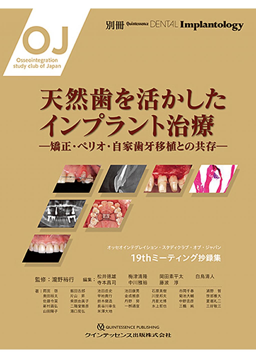 天然歯を活かしたインプラント治療 別冊QDIの購入ならWHITE CROSS