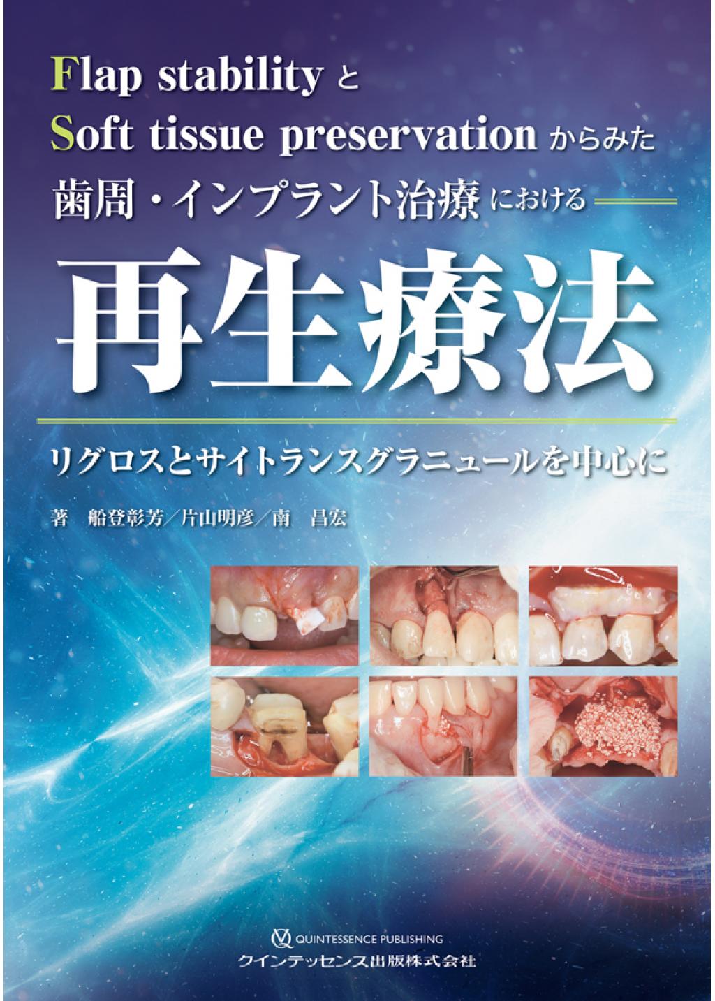 歯周・インプラント治療における再生療法の購入ならWHITE CROSS