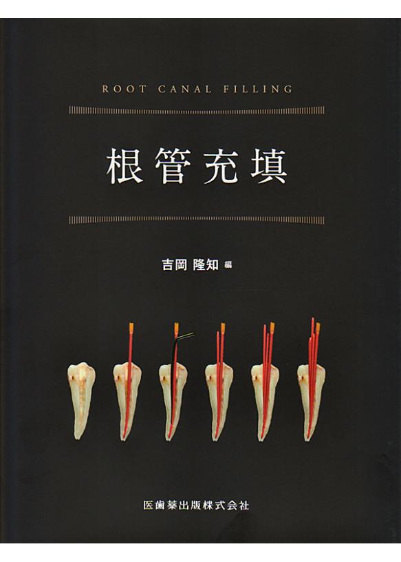 臨床根管解剖 基本的知識と歯種別の臨床ポイント - 本