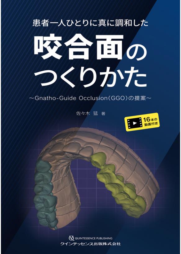 患者一人ひとりに真に調和した咬合面のつくりかたの画像です