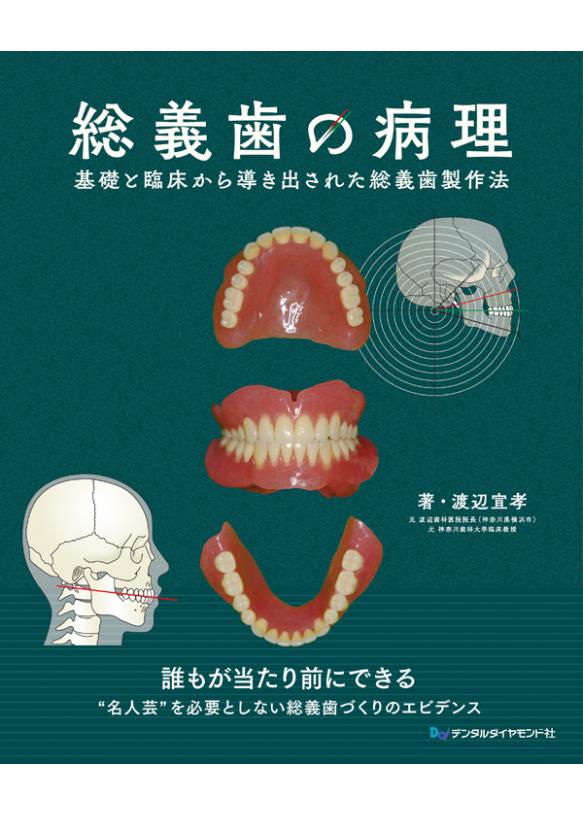 総義歯の病理の画像です