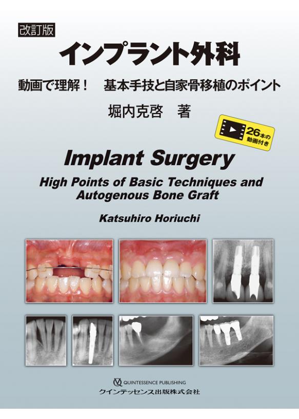 改訂版　インプラント外科の画像です