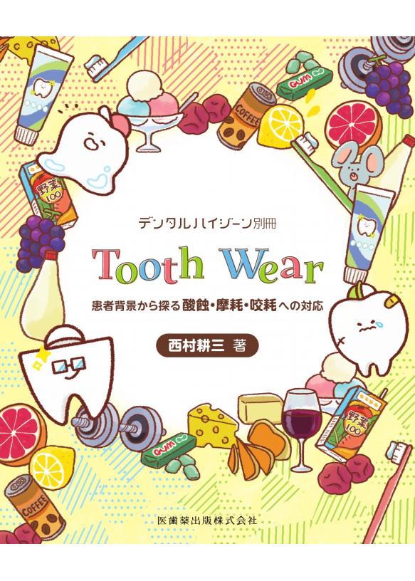 Tooth Wearの画像です