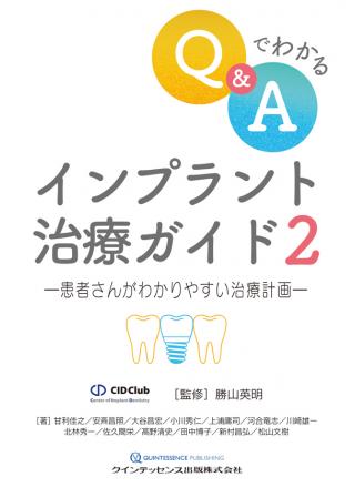 Q&amp;Aでわかる インプラント治療ガイド2の画像です