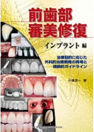 前歯部審美修復 天然歯編の購入ならWHITE CROSS