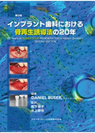 ITI Treatment Guide Volume 7 インプラント患者への歯槽堤増生術の 