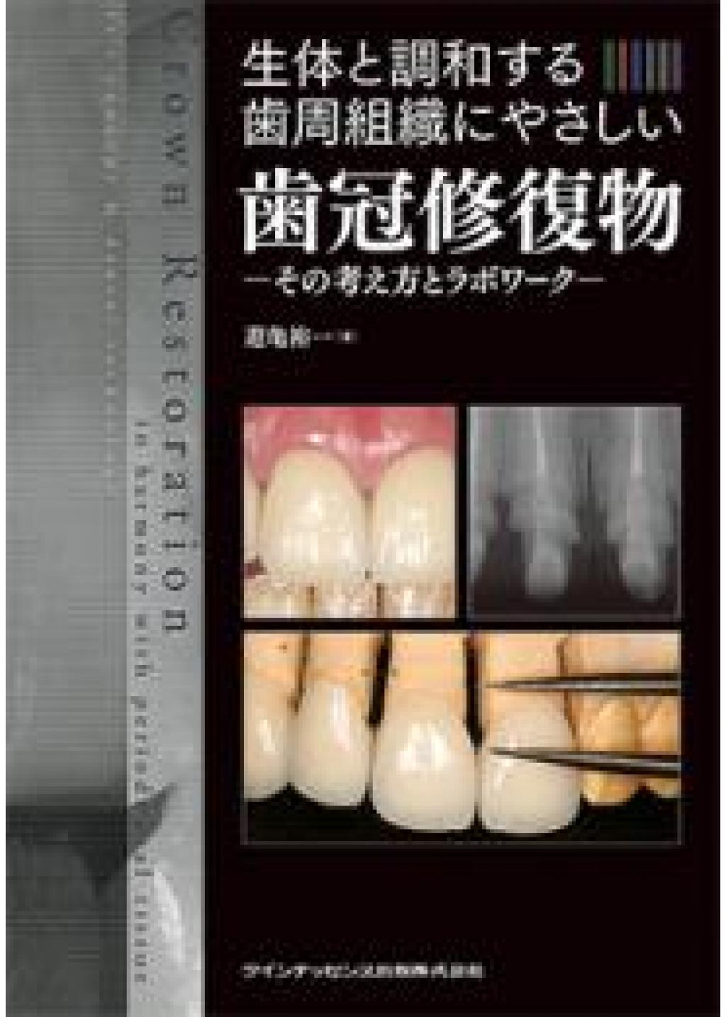 生体と調和する歯周組織にやさしい歯冠修復物の購入ならWHITE CROSS