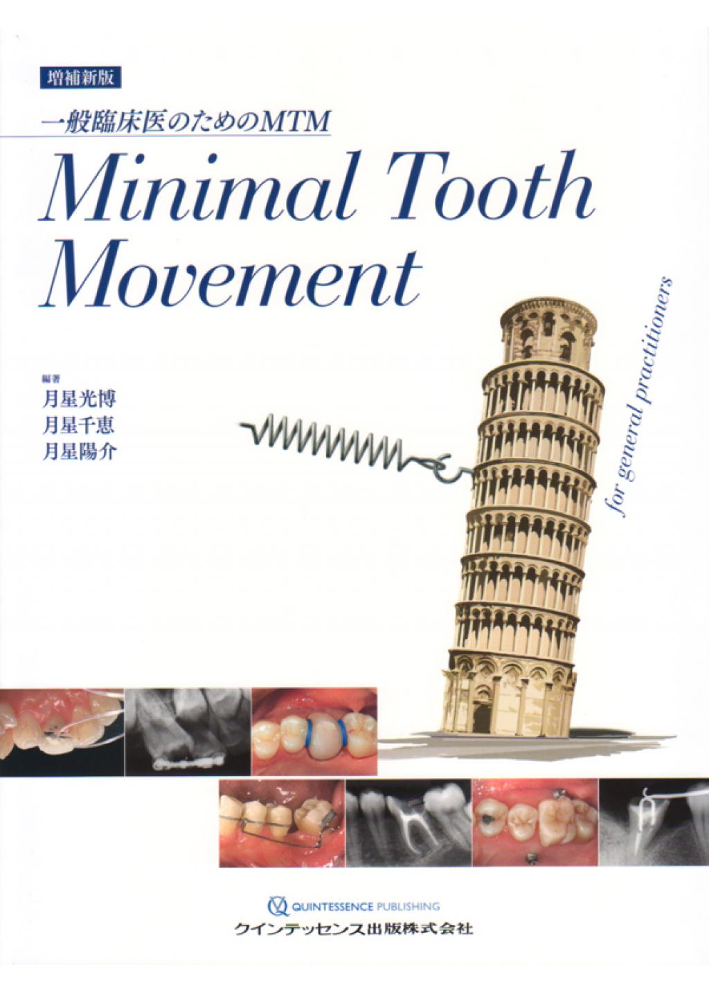増補新版 Minimal Tooth Movementの購入ならWHITE CROSS
