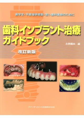 改訂新版 歯科インプラント治療ガイドブックの購入ならWHITE 